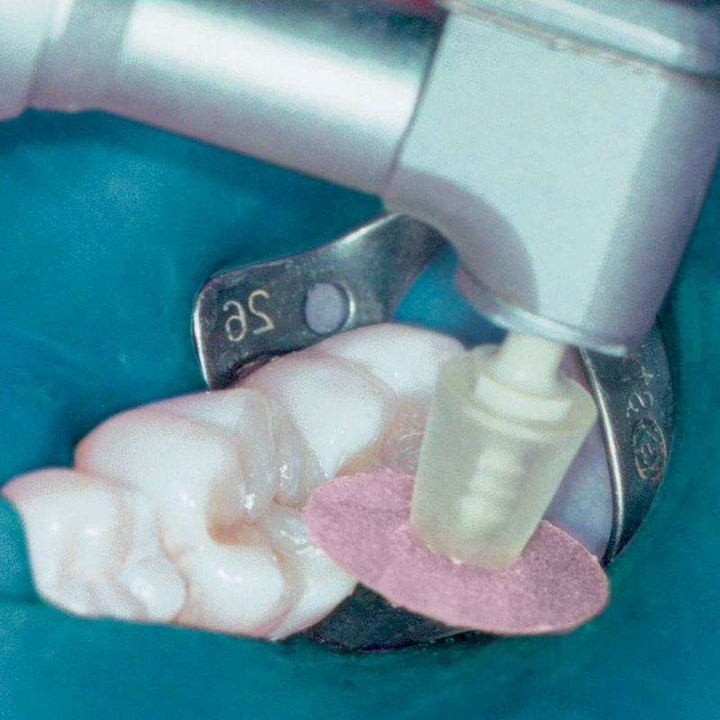 Disco De Lixa Superfix Sort. C-25 Tdv C Mandril